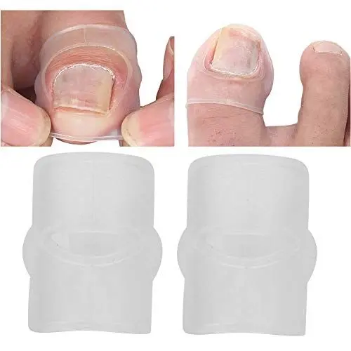 Produktbild: 2pcs Silikon Eingewachsene Zehennagel Korrekturwerkzeug, Elastischer Patch Gebogene Zehennägel Klammer Aufkleber, Schmerzlinderung Paronychie Behandlung Korrektor Zehennagelpflege Schützt