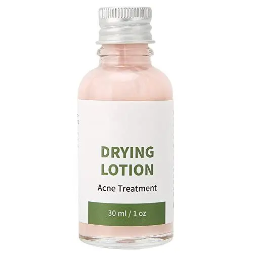 Produktbild: Akne-Serum, Akne-Spot-Behandlung Pflegende Haut, Gesichtsserum Zur Beseitigung Schwerer Akne, Feuchtigkeitsspendende Gesichtspflege für Frauen und Männer 30ml