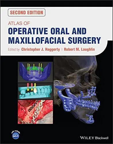 Produktbild: Atlas of Operative Oral and Maxillofacial Surgery