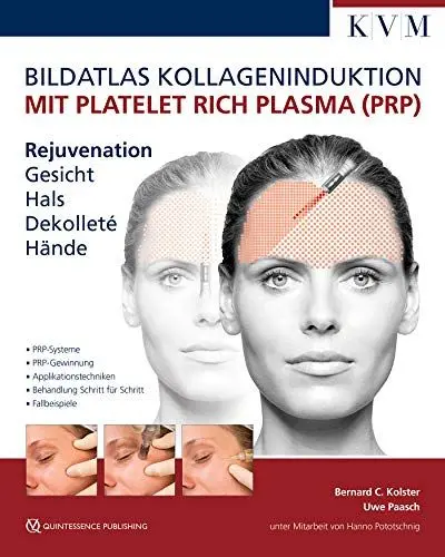 Produktbild: Bildatlas Kollageninduktion mit Platelet Rich Plasma (PRP): Rejuvenation Gesicht - Hals - Dekolleté - Hände
