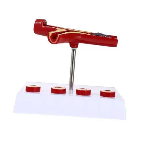 Produktbild: BUGUUYO Gefäßmodell Puppe Kardiovaskuläres Lernmodell Atherosklerose Medizinisches Modell -arteriosklerose-modell Menschliche Atherosklerose Anatomische Modelle Skelett Herz Pvc