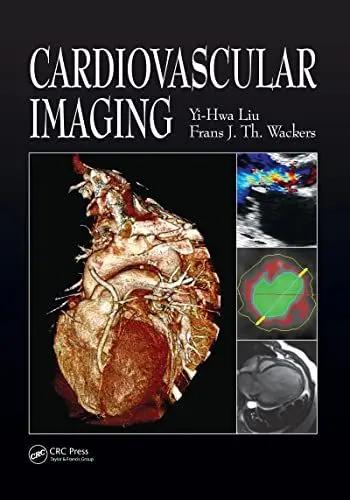 Produktbild: Cardiovascular Imaging