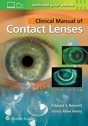 Produktbild: Clinical Manual of Contact Lenses