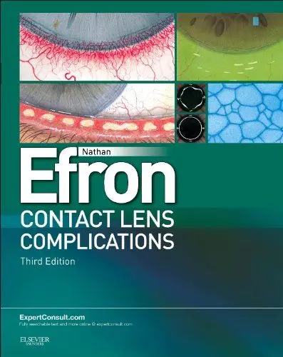 Produktbild: Contact Lens Complications: Expert Consult - Online and Print