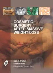 Produktbild: Cosmetic Surgery After Massive Weight Loss