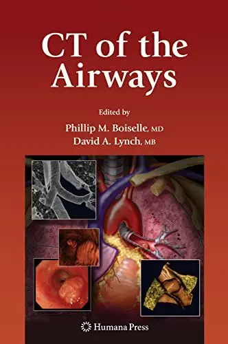 Produktbild: CT of the Airways (Contemporary Medical Imaging)
