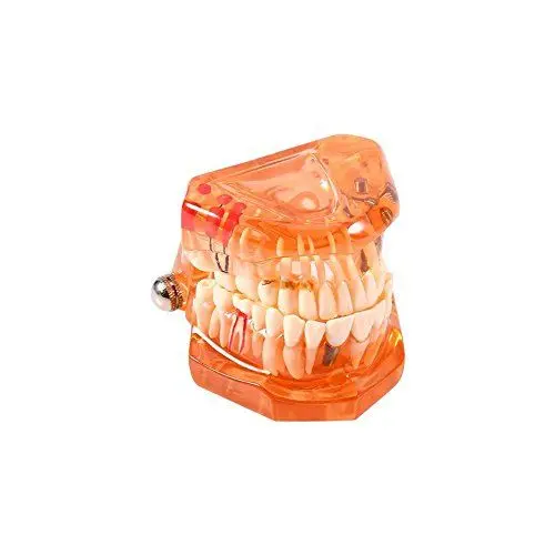 Produktbild: Zähne Herausnehmbar Zahnmodell Zahnprotesen Demonstration Zähne Modell für Studie Lehren (Orange)