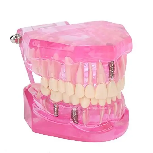 Produktbild: Dentalmodell, Erwachsenenzahnmodell klar für den Unterricht für das Studium