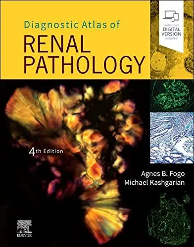 Produktbild: Diagnostic Atlas of Renal Pathology