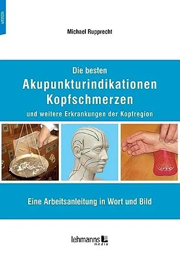 Produktbild: Die besten Akupunkturindikationen Kopfschmerzen und weitere Erkrankungen der Kopfregion: Eine Arbeitsanleitung in Wort und Bild