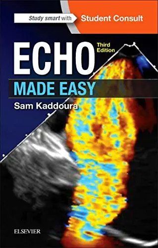 Produktbild: Echo Made Easy: Student Consult