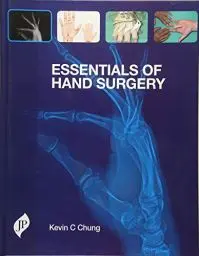 Produktbild: Essentials of Hand Surgery