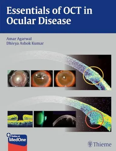 Produktbild: Essentials of OCT in Ocular Disease: Includes videos online
