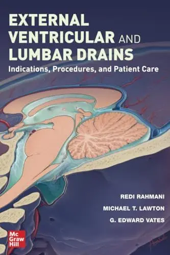 Produktbild: External Ventricular and Lumbar Drains: Indications, Procedures, and Patient Care