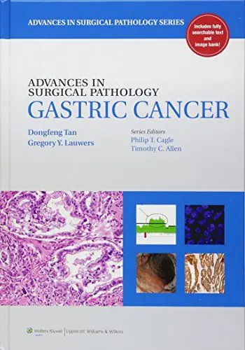 Produktbild: Gastric Cancer (Advances in Surgical Pathology)
