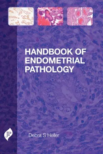 Produktbild: Handbook of Endometrial Pathology