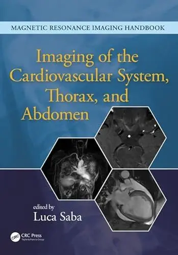 Produktbild: Imaging of the Cardiovascular System, Thorax, and Abdomen (Magnetic Resonance Imaging Handbook)