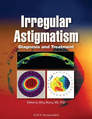 Produktbild: Irregular Astigmatism: Diagnosis and Treatment
