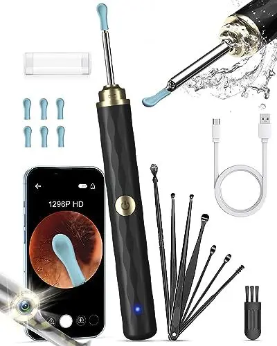 Produktbild: Kekoy Ohrenschmalz Entferner Otoskop mit Licht, 1296P Ohrenreiniger mit Kamera, WiFi Ohrreiniger mit Kamera, Wiederaufladbar Ear Cleaner, Ohrreiniger für Erwachsene und Kinder（Schwarzes Gold）