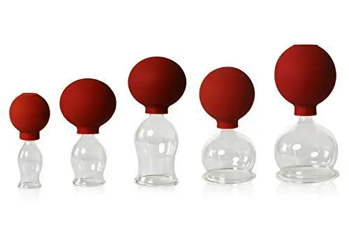 Produktbild: Lauschaer Glas 5er Schröpfglas-Set mit Ball 20-30-40-50-60mm zum professionellen, medizinischen,feuerlosen Schröpfen mundgeblasen, handgeformt, Schröpfglas, Schröpfgläser, Lauschaer Glas