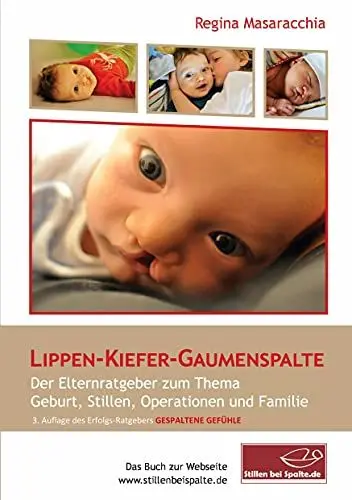 Produktbild: Lippen-Kiefer-Gaumenspalte: Gespaltene Gefühle: 3. Auflage