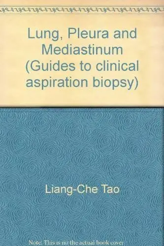 Produktbild: Lung, Pleura, and Mediastinum (Guides to Clinical Aspiration Biopsy)