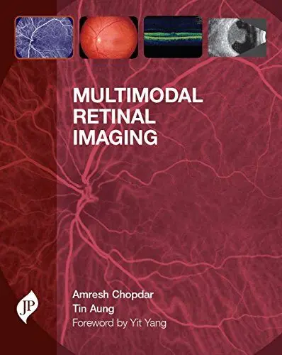 Produktbild: Multimodal Retinal Imaging