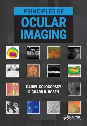 Produktbild: Principles of Ocular Imaging