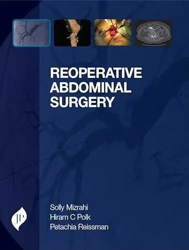 Produktbild: Reoperative Abdominal Surgery