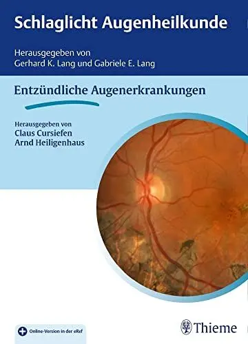Produktbild: Schlaglicht Augenheilkunde: Entzündliche Erkrankungen