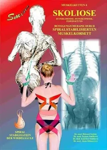 Produktbild: Skoliose: Bewegungstherapie durch spiralstabilisierten Muskelkorsett