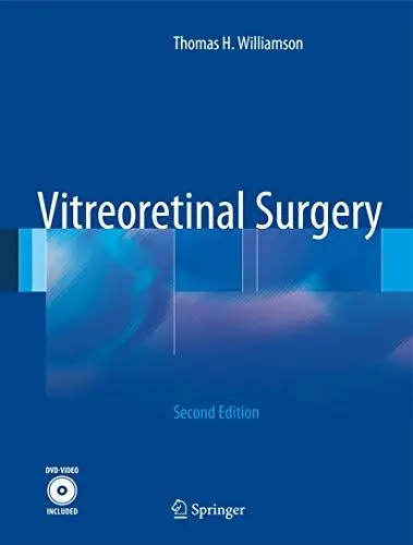 Produktbild: Vitreoretinal Surgery