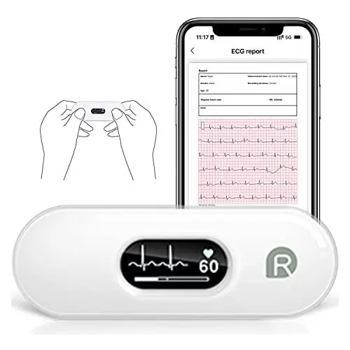 Produktbild: Wellue DuoEK-S Mobiles EKG Gerät, Bluetooth Wireless Tragbarer Herzmonitor mit 0,96 Zoll OLED-Bildschirm, 30s - 5 Min Überwachung, Herzfrequenzmonitor, APP für iOS und Android